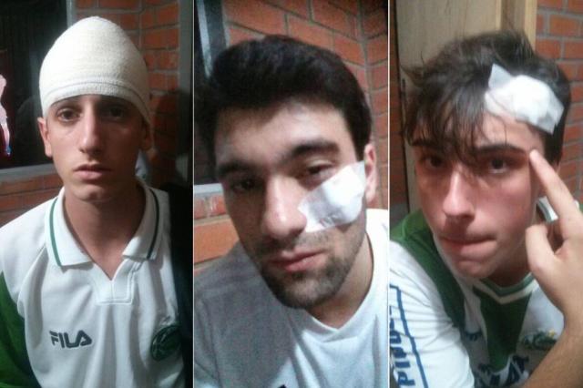Torcedores do Juventude relatam agressões da torcida do Inter em Novo Hamburgo Montagem sobre as fotos de arquivo pessoal de Luã Lorenzi/ Torcedores do Juventude relatam agressões da torcida do Inter em Novo Hamburgo Montagem sobre as fotos de arquivo pessoal de Luã Lorenzi/